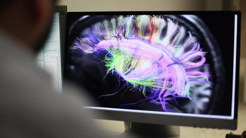 Deliryumun nedeni bulundu!