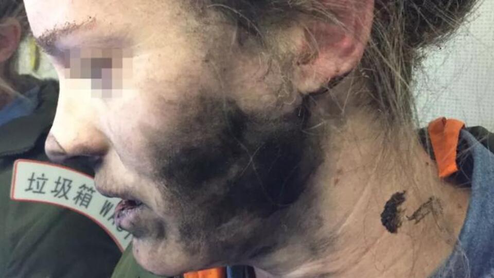 Kulaklık kadını bu hale getirdi