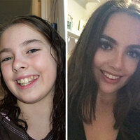 Diş teli taktırdıktan sonra adeta evrim geçirdiler