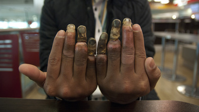 Türkiye hayalinin bedelini bu parmaklarla ödedi!