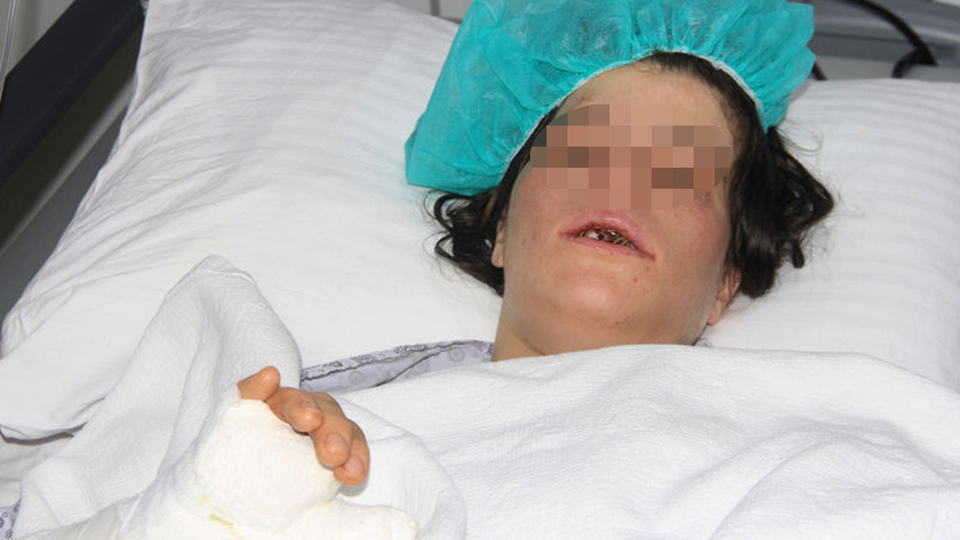 İşkenceci koca! Suriyeli mühendis, eşini levyeyle dövüp, dişlerini söktü