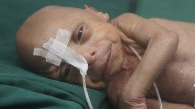 Bangladeş'te yaşlı bebek doğdu!