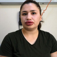 Estetik faciası! Görenleri hayrete düşürdü