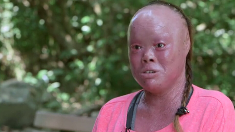 Görüntüsü nedeniyle ailesi onu sokağa terk etti! Ama...