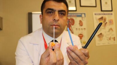 Türk doktordan dünyaya büyük çalım!