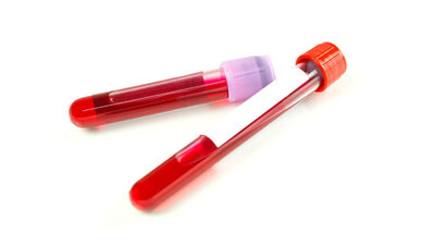 İşte kan vermenin faydaları...