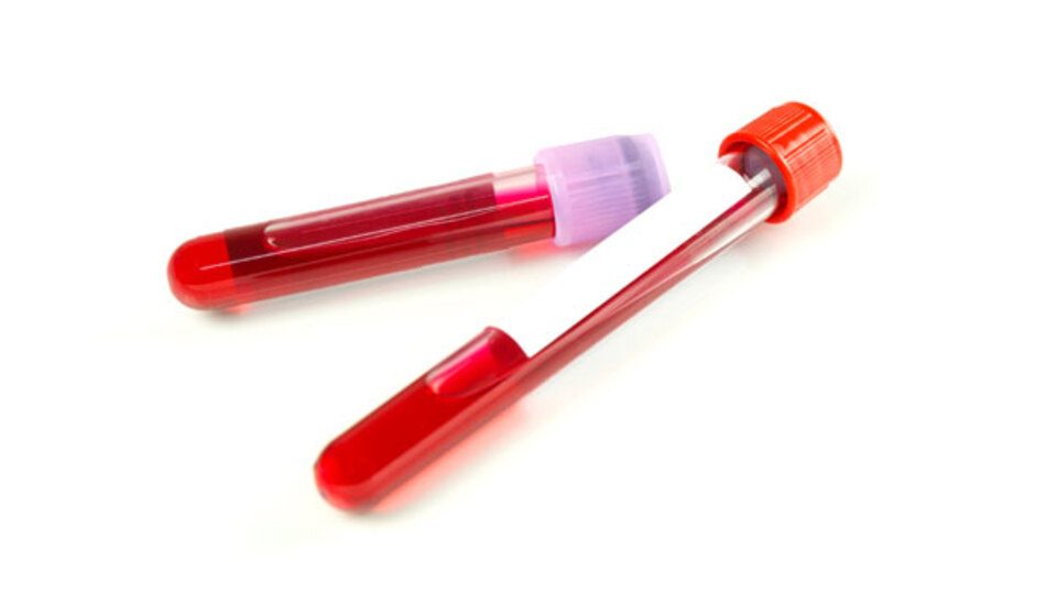 İşte kan vermenin faydaları...