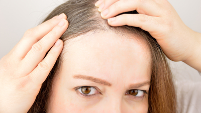 Artarak dökülen saçlara dikkat!