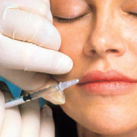 Sosyal medya baskısı gençleri botoksa itiyor