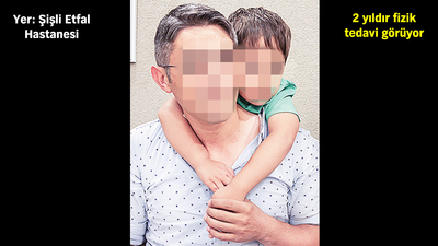 8 aylıkken beyin ameliyatı oldu, sırtı ve kalçası yandı