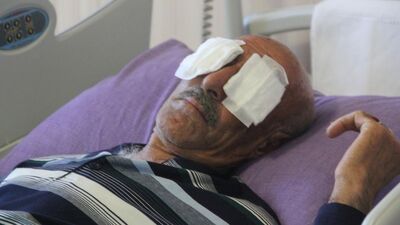 Kamyonet kasasında gözlerini oydu!