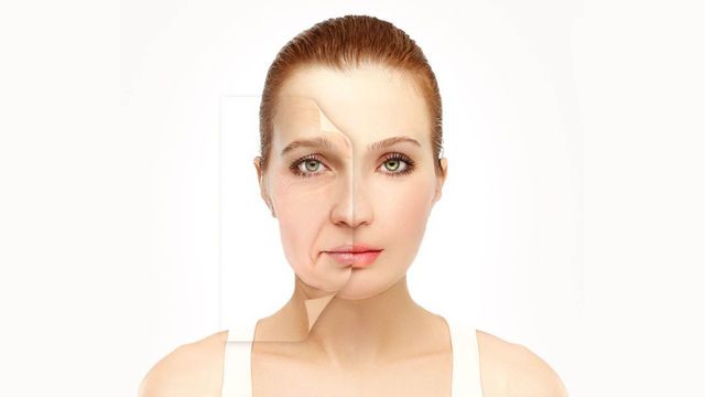 Ameliyatsız ve narkozsuz yüz germe operasyonu