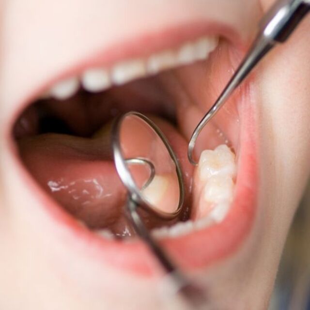 Ağız sağlığında titanyum diş dönemi başladı!