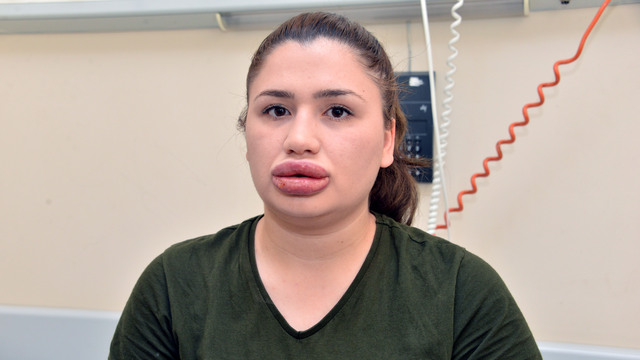 Silikon mağduru Merve hemşireye şoke eden suçlama