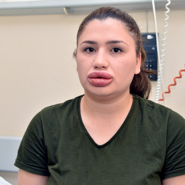 Silikon mağduru Merve hemşireye şoke eden suçlama