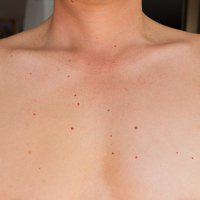 Vücudunuzdaki benlere bakın! Eğer 3 farklı renk varsa...