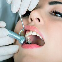 İmplant yaptırırken 3 noktaya dikkat!