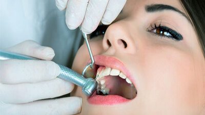 İmplant yaptırırken 3 noktaya dikkat!