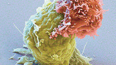 Kanser tedavisinde immünoterapi