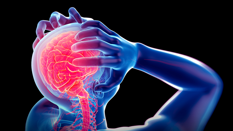 Dikkat! Beyin kanaması en çok bu saatlerde görülüyor!