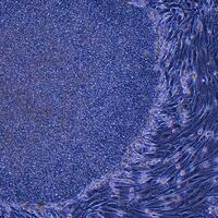 Ankara Üniversitesinden 'kök hücre' uyarısı: Türk Ceza Kanununa aykırı