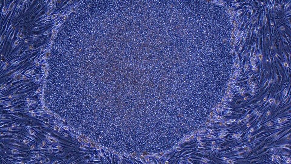 Ankara Üniversitesinden 'kök hücre' uyarısı: Türk Ceza Kanununa aykırı