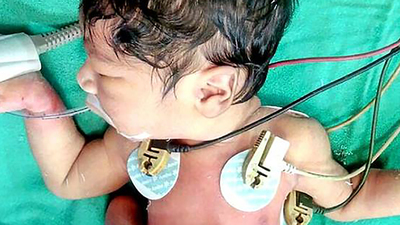 Şeytan alameti düşüncesiyle bebeği öldürmek istediler