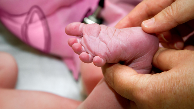 Yenidoğan bebeklerde ilk 24 saat çok önemli