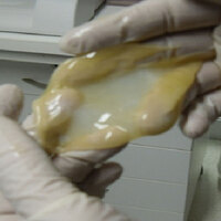 Türk bilim insanına ABD'den ödül! Kan ve kök hücreden yapay deri üretti