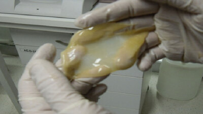 Türk bilim insanına ABD'den ödül! Kan ve kök hücreden yapay deri üretti