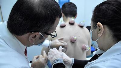 Hacamat yaptırmadan önce işte bilmeniz gerekenler...