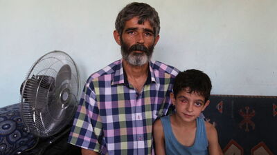 "Protez göz" için baba oğul çöp topluyor!