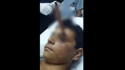 Başına ekmek bıçağı saplandı