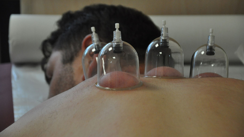 Devletten doktora sülüklü, kupalı hacamat eğitimi