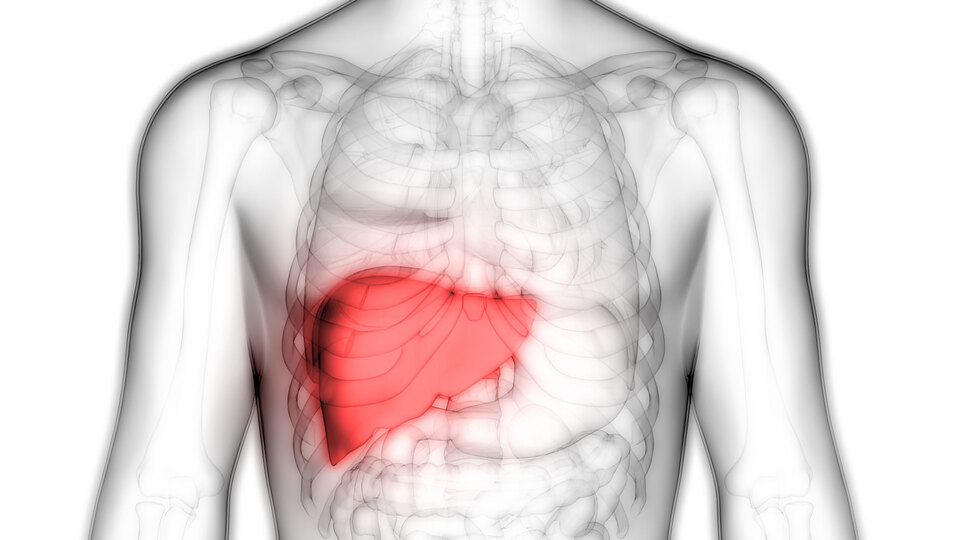 Karaciğer sirozu hakkında tüm bilmeniz gerekenler