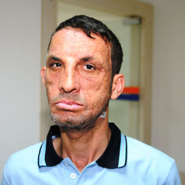 İlk yüz nakilli Uğur Acar'ın yargılandığı cinayet davasında karar çıktı!