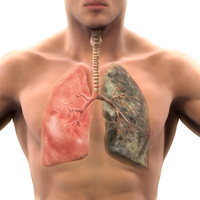 KOAH nedir? Tedavisi var mı?