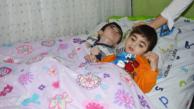 İki çocuğu da dünyada nadir görülen o hastalığın pençesinde!