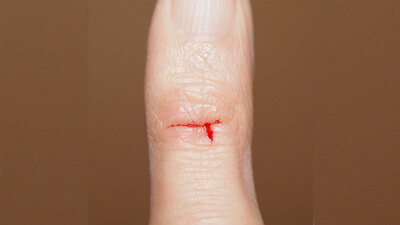 Herkes merak ediyor! Kağıt kesiği neden çok acıtır?