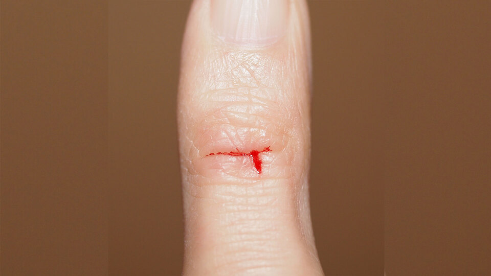 Herkes merak ediyor! Kağıt kesiği neden çok acıtır?