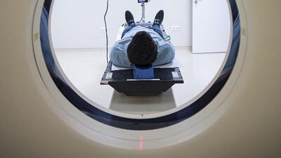 Alzheimer'ı erken teşhis eden yöntem geliştirildi!