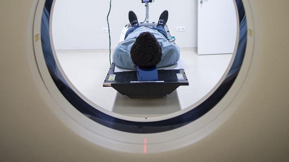 Alzheimer'ı erken teşhis eden yöntem geliştirildi!