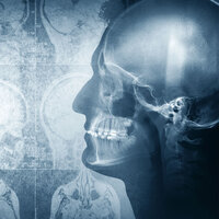 Bu alışkanlıklar beyni yaşlandırıyor!