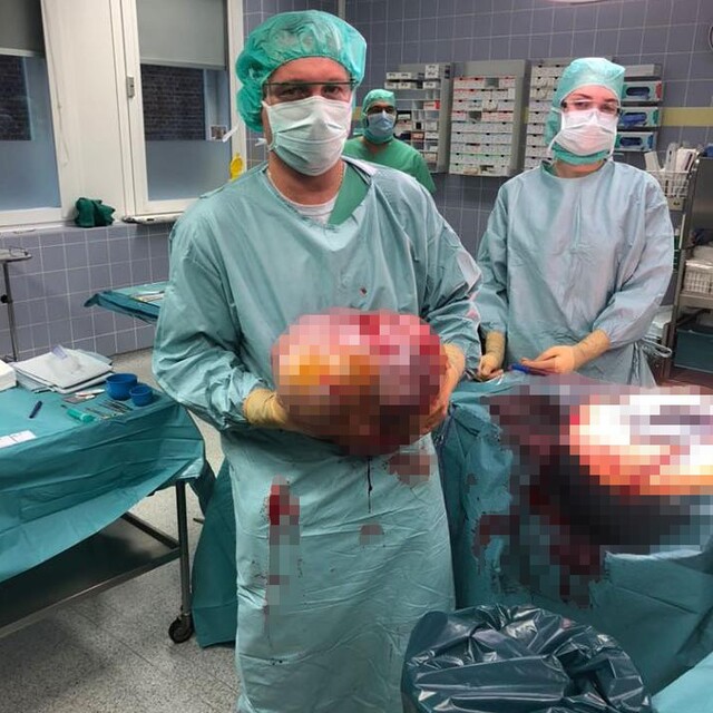 Almanya'da kadın hastadan 10.2 kilo ağırlığında tümör çıktı