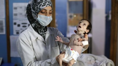 BM: Doğu Guta'daki açlık son bulmalı