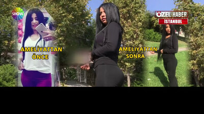 "Brezilya kalçası olmadı" dedi, hastaneye dava açtı!