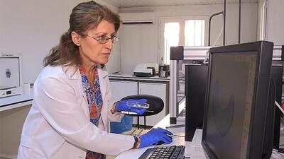 Kemik kırıklarında 'kök hücre' devrimi