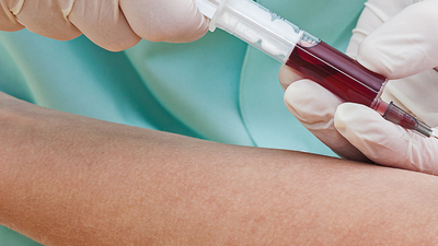 Ölene kadar sağlıklı yaşamak mümkün mü?