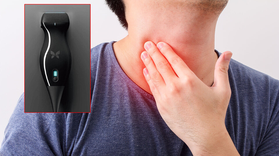 Telefonla kanserini keşfetti