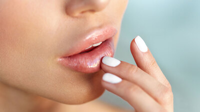 Dudak estetiğinde işte dikkat edilmesi gerekenler!